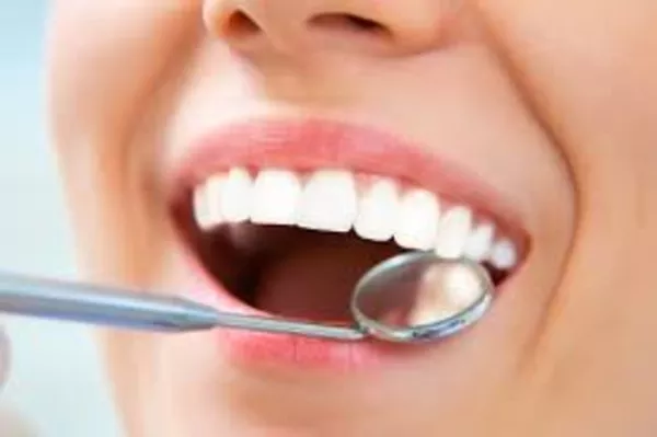 Профессиональная чистка зубов,  отбеливание ультразвуком п.Колодищи 2